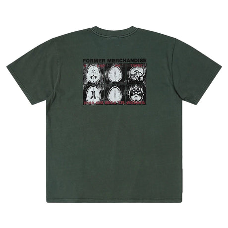 Former Brain Scan Oversized T-Shirt